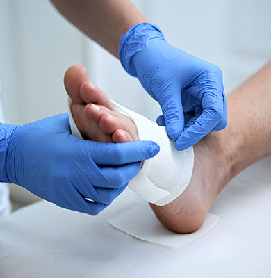 Arterial Ulcers