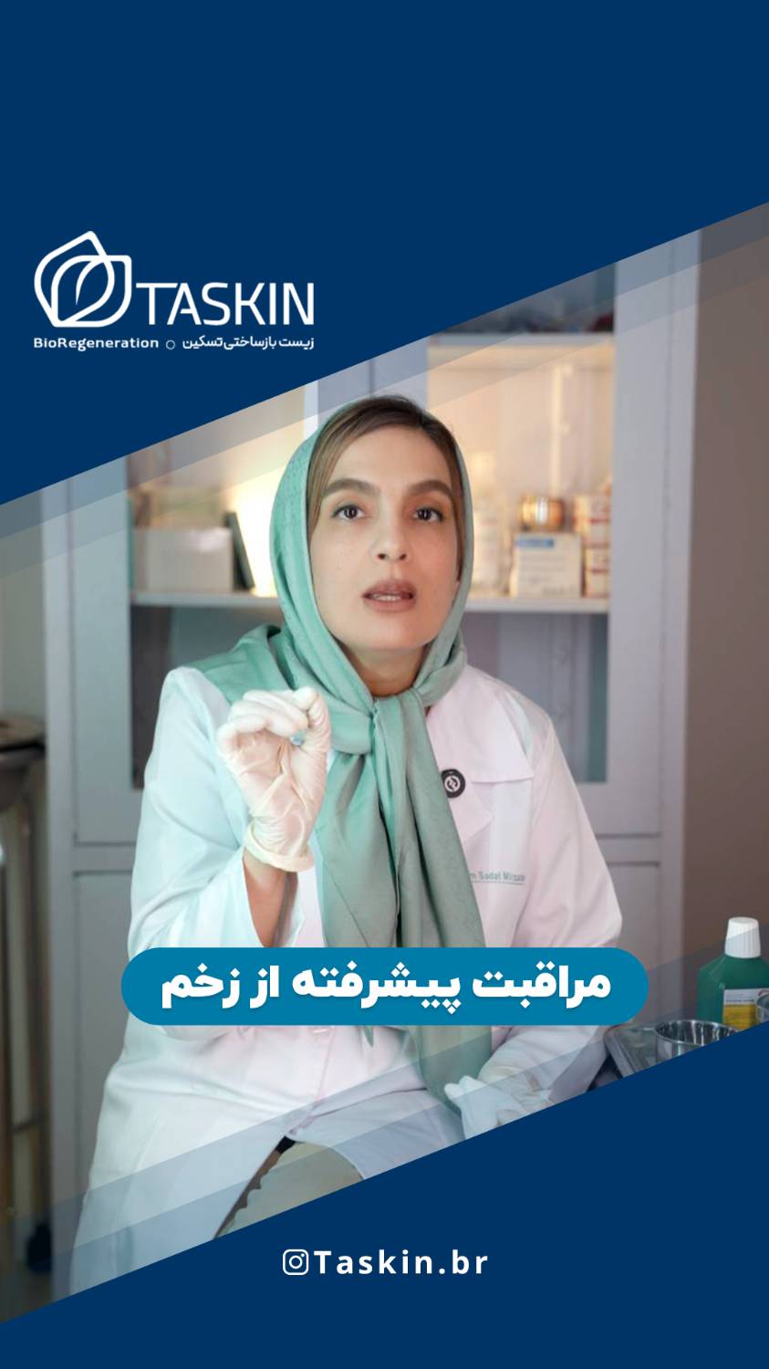 مراقبت پیشرفته از زخم
